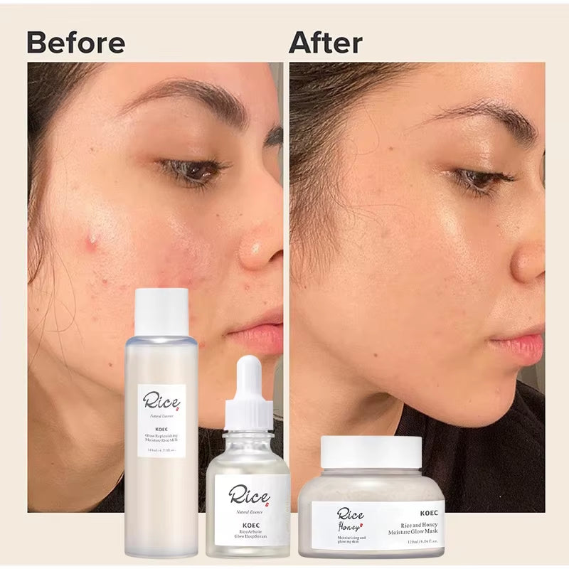 Beauty Rice Honey Facial Skincare 3Pieces Set Moisturizing Arbutin Serum Milk Toner Smear Glow Mask Korean Brand Facial Skincare